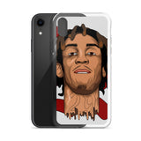 Young Adz iPhone Case - CustomSneakersGB